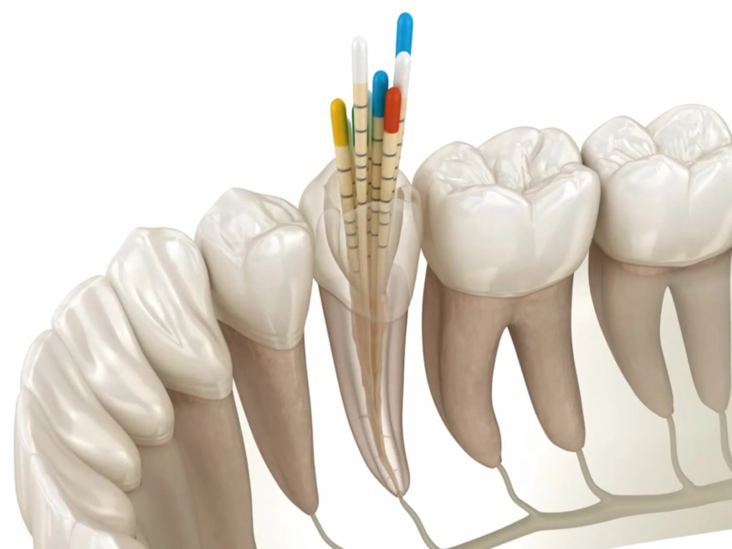 10Endodoncia