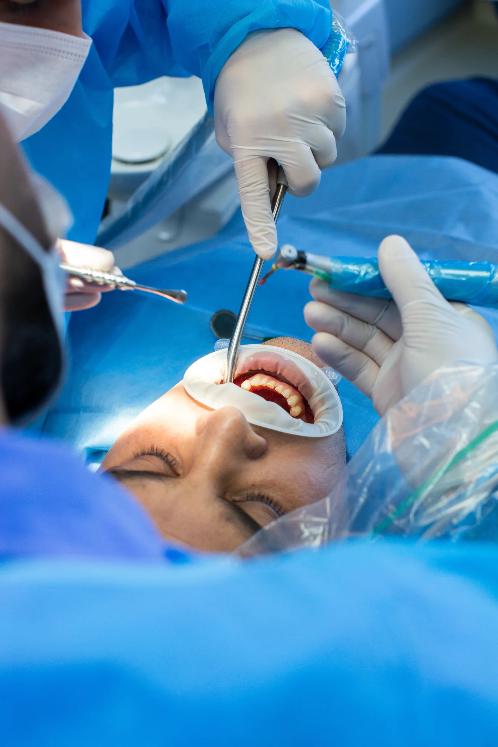2Cirugía Oral y Maxilofacial