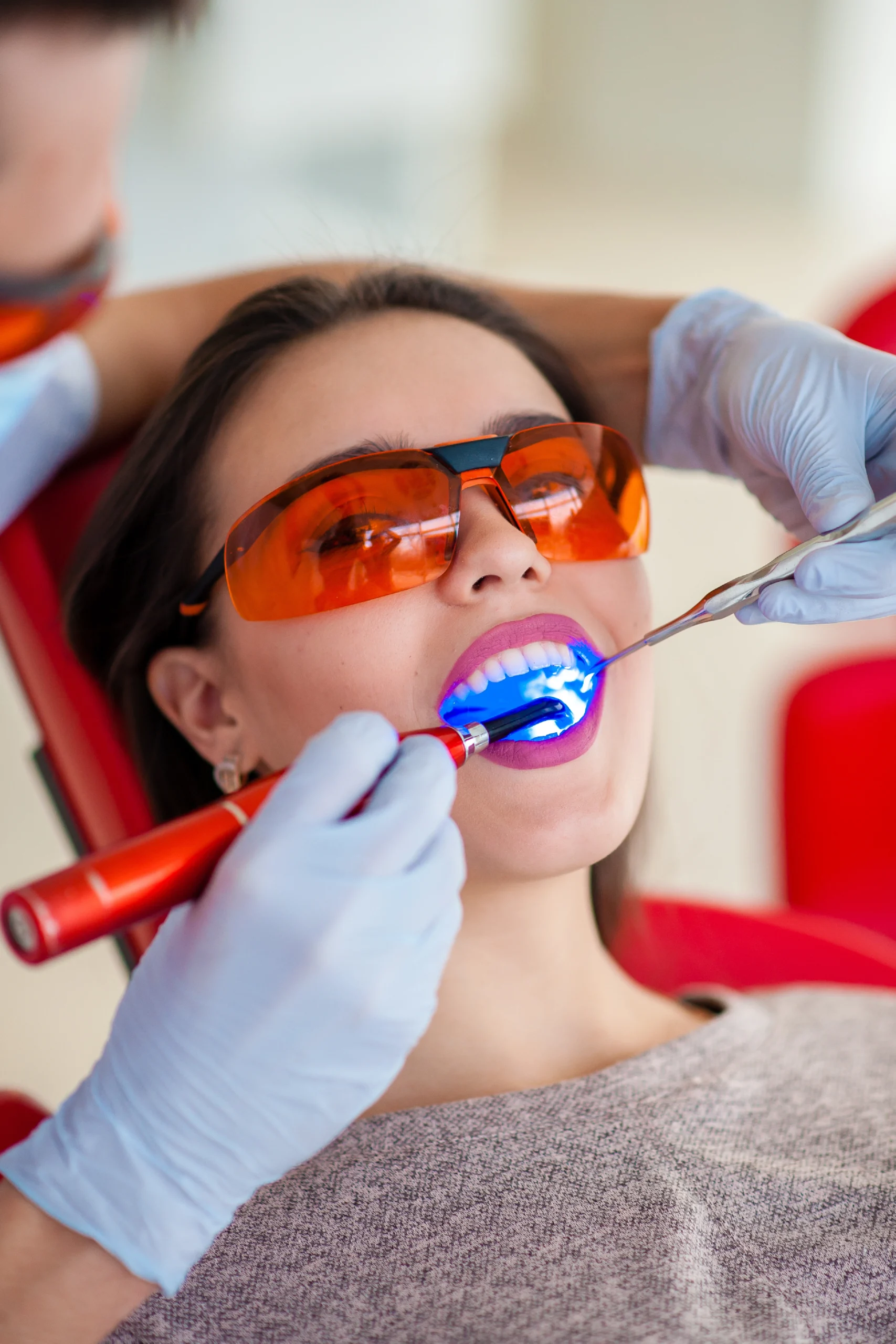 5Blanqueamiento Dental